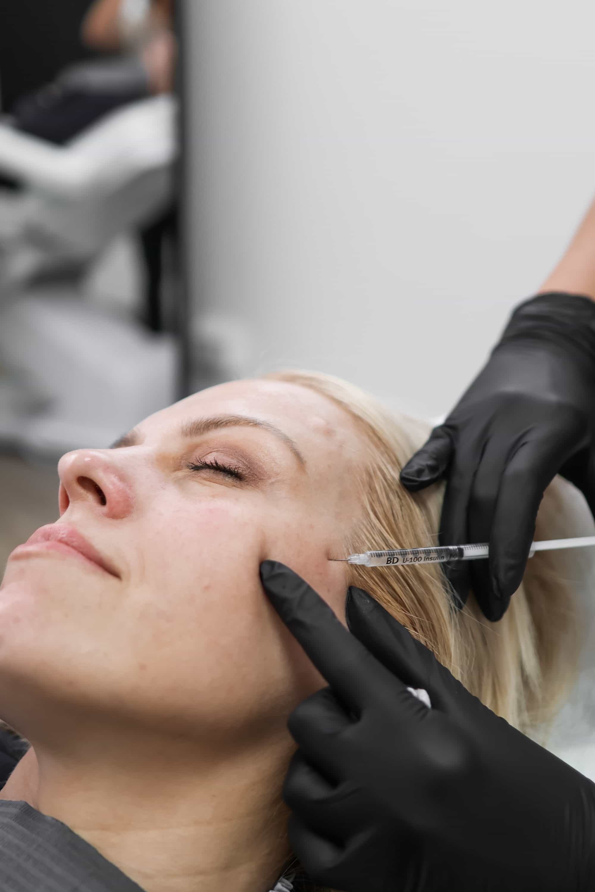 How Sculptra Improves Skin Firmness in Surrey