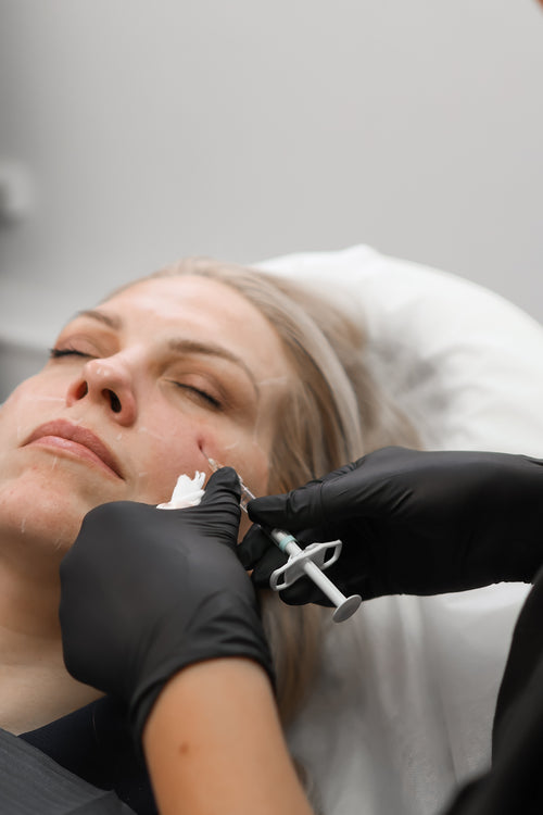 How Often Do You Need To Top Up Lip Filler